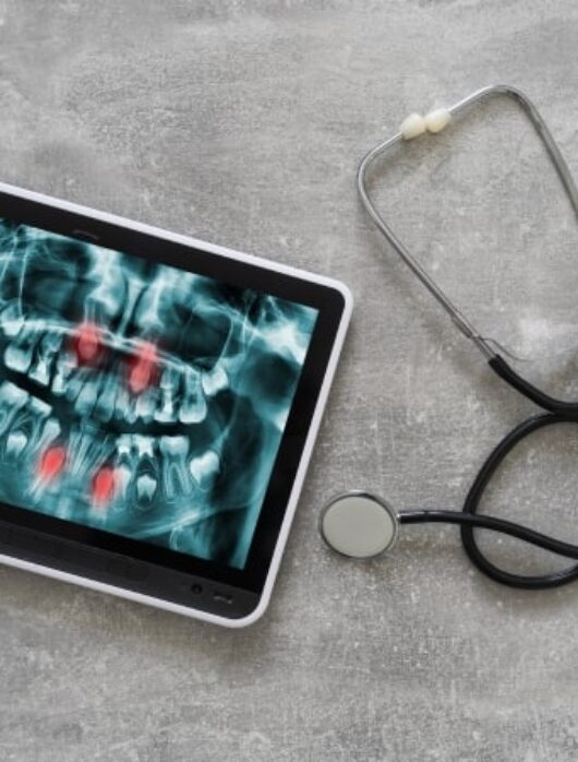 Treatment - Parkview Dental