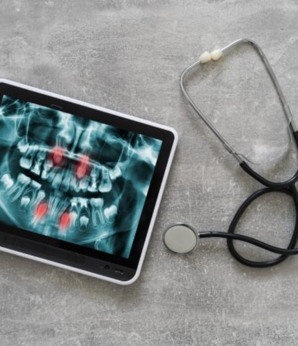 Treatment - Parkview Dental