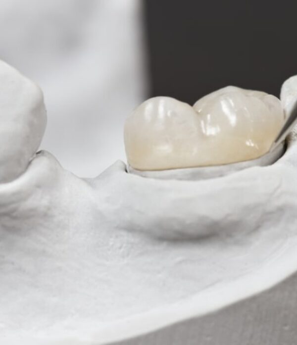 Treatment - Parkview Dental